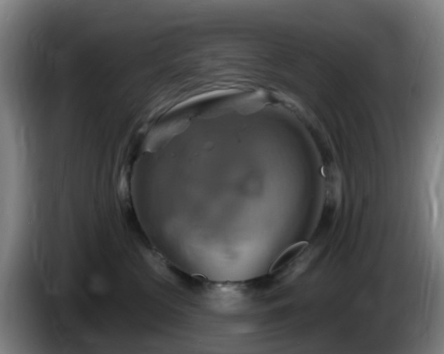 X0000086020573200703301035