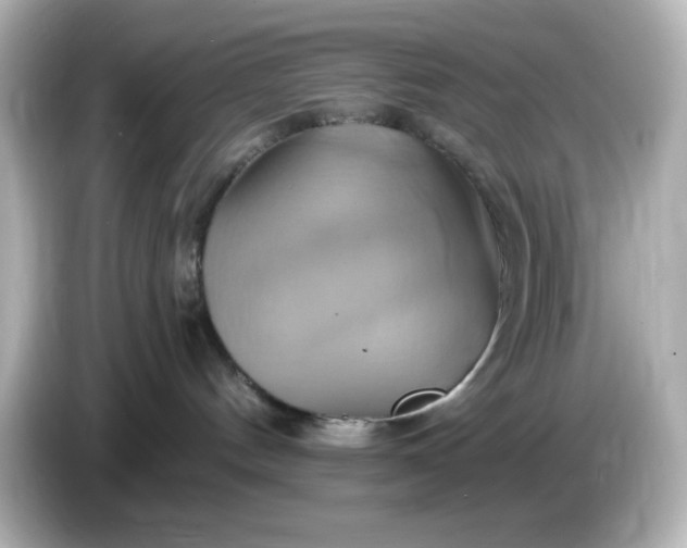 X0000086020144200704091120