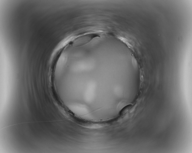 X0000086020149200704091120
