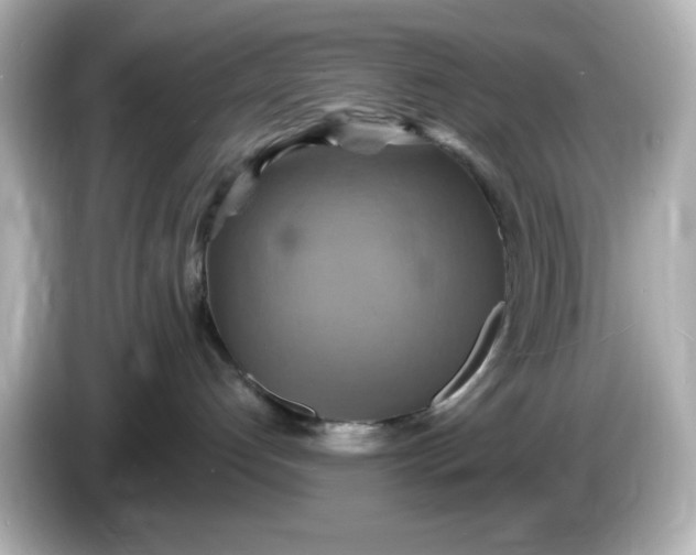 X0000086020192200704091120