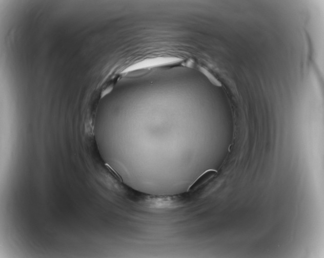 X0000086020384200704091118