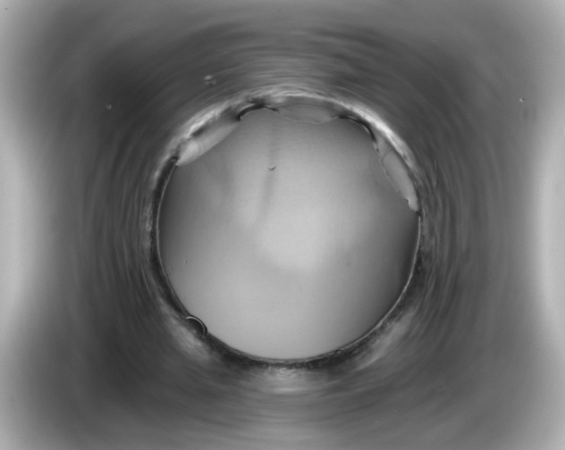 X0000086020437200704091116