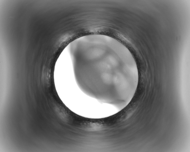 X0000086020592200704091115