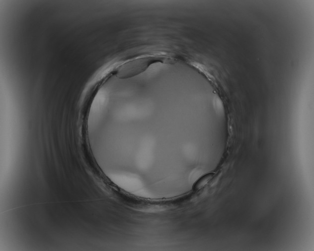 X0000086020149200704131857