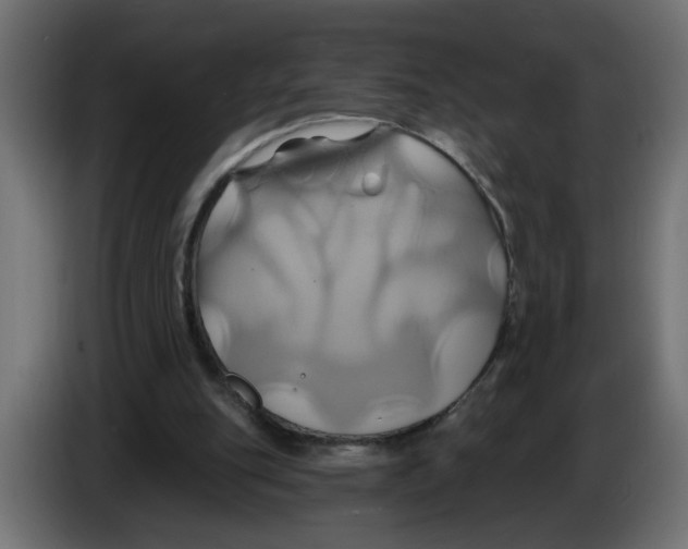 X0000086020151200704131857