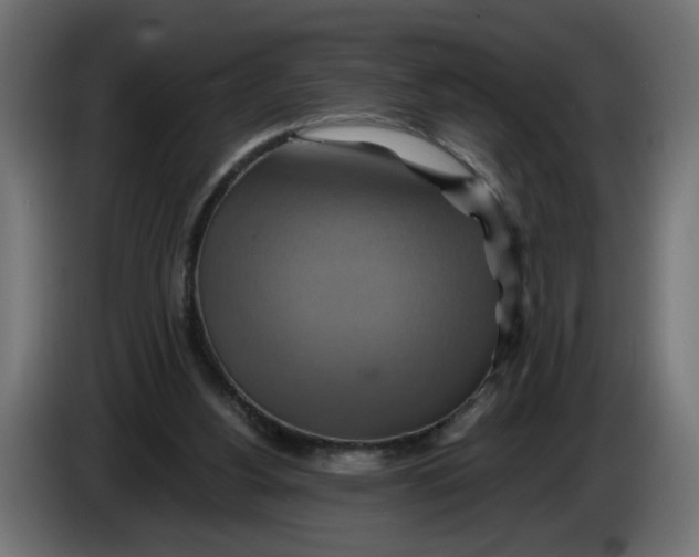 X0000086020156200704131857