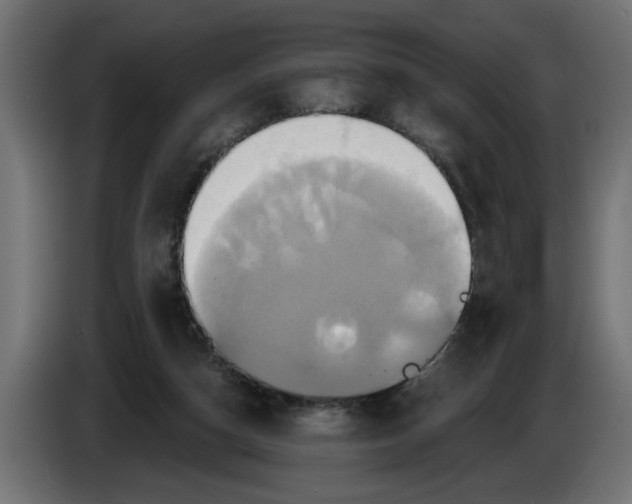 X0000086020162200704131857