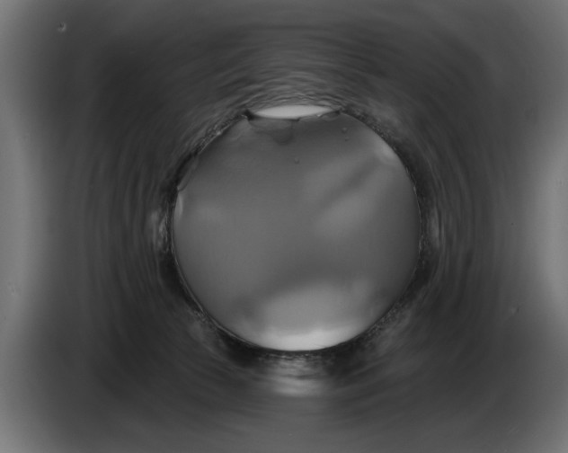 X0000086020177200704131858