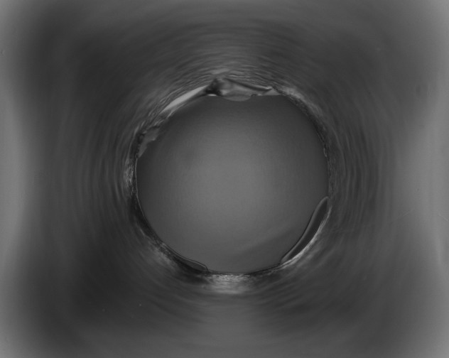 X0000086020192200704131858