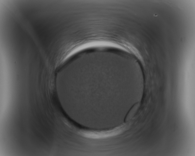 X0000086030017200703301104