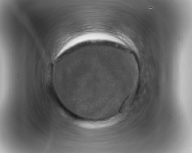 X0000086030017200704091141