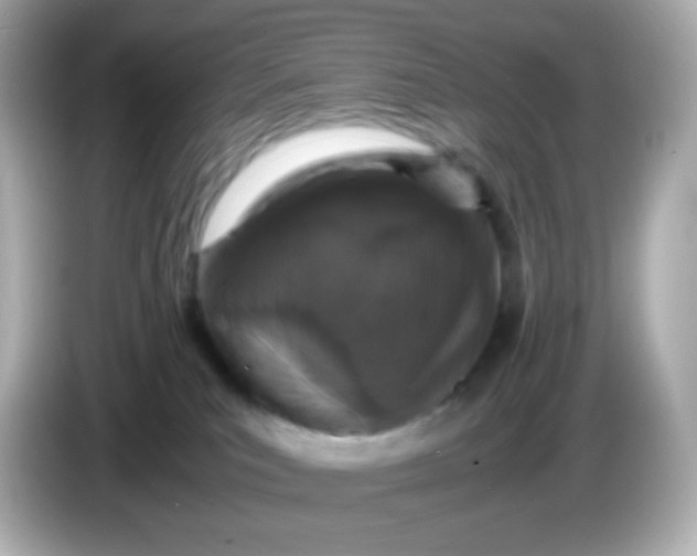 X0000086030039200704091140