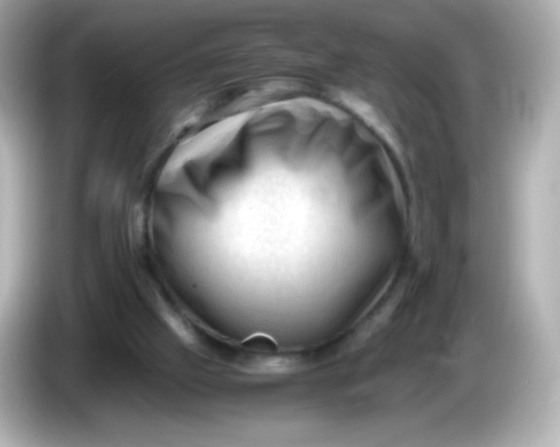 X0000086030057200704091140