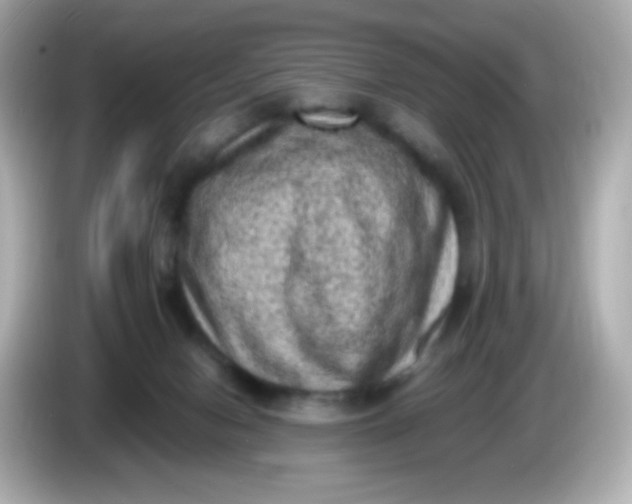 X0000086030078200704091140