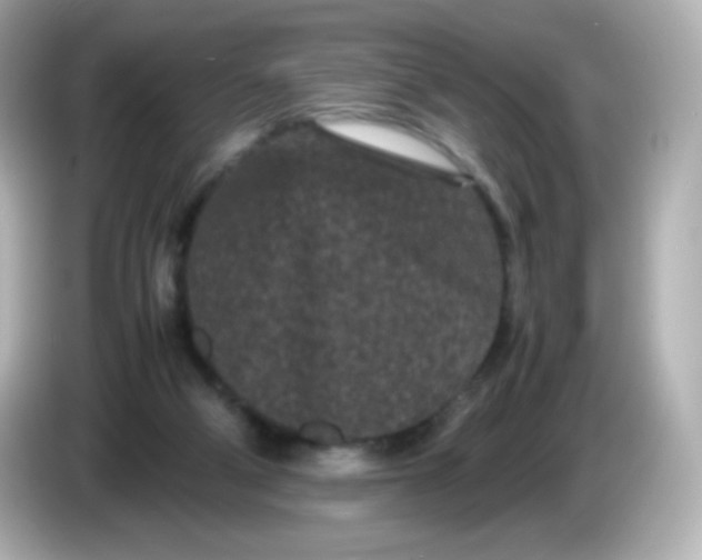 X0000086030114200704091139