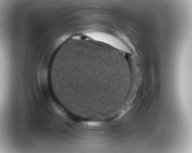 X0000086030154200704091139