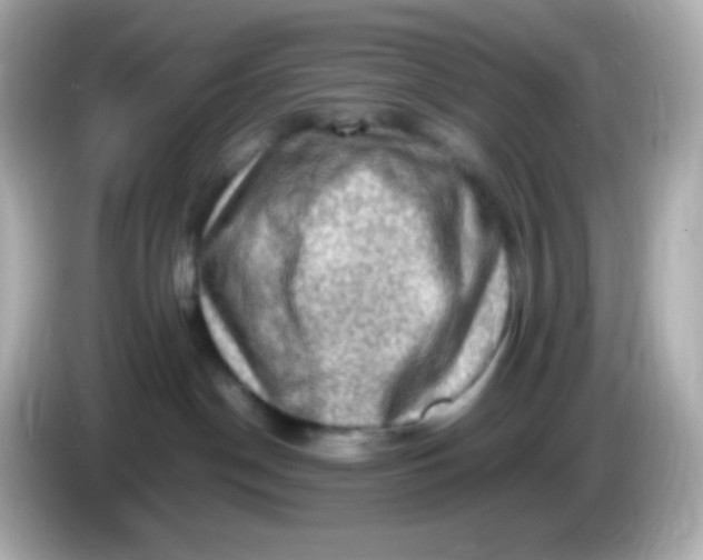 X0000086030190200704091139