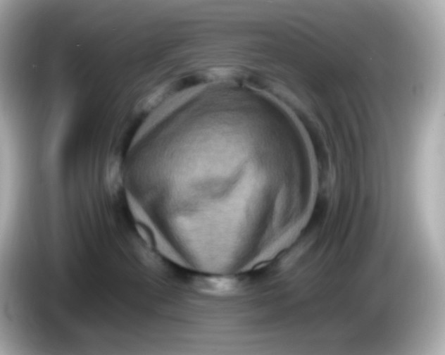 X0000086030478200704091136