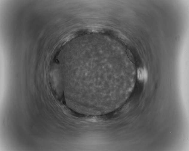 X0000086031155200704091127