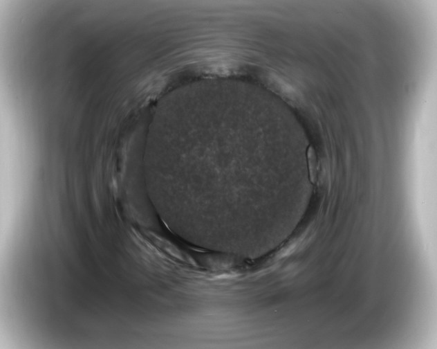 X0000086031202200704091126