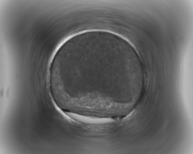 X0000086031527200704091123