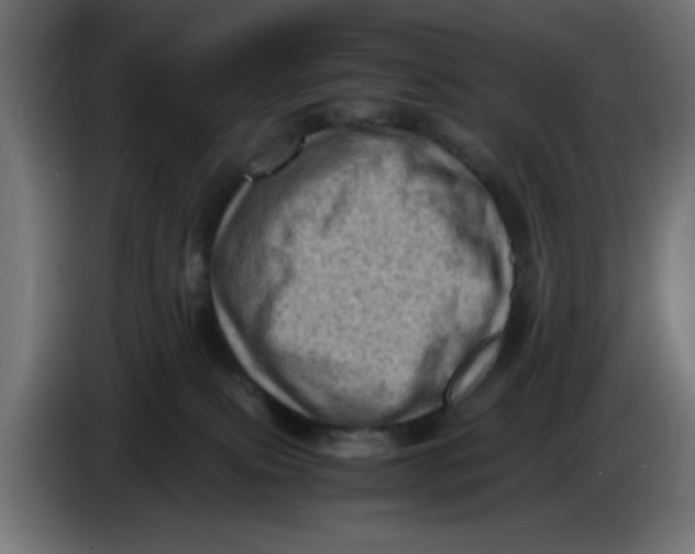 X0000086030087200704131922