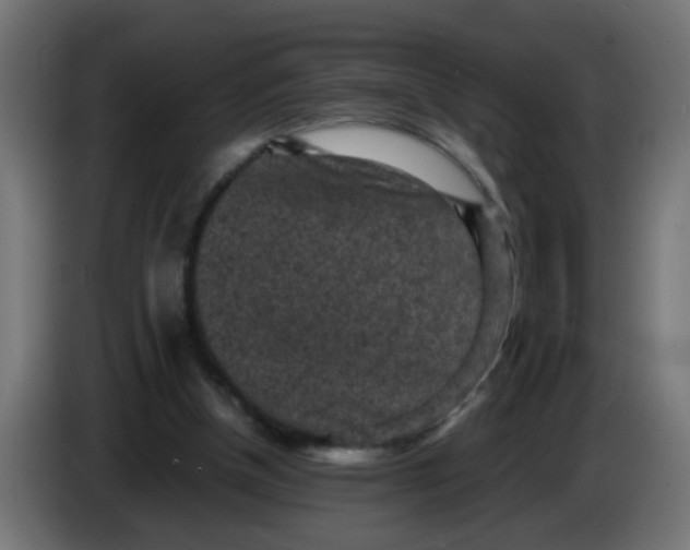 X0000086030154200704131920