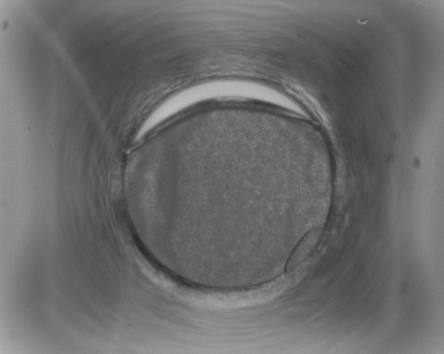 X0000086030017200704201957