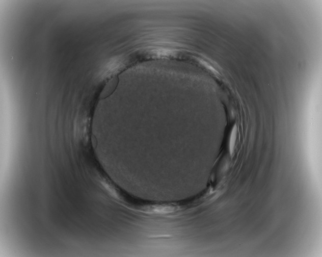 X0000086050462200704091213