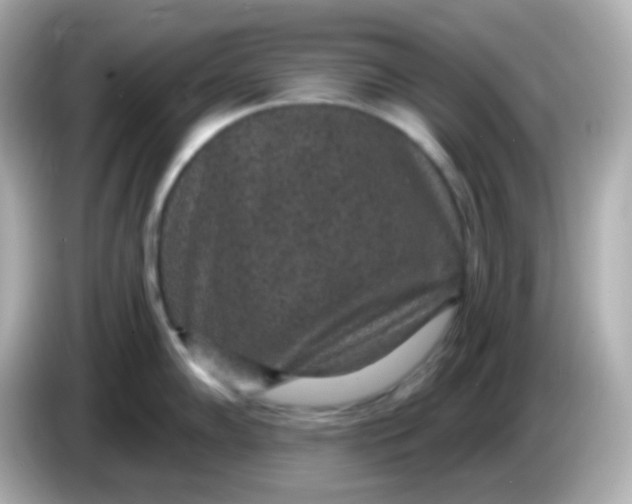 X0000086051102200704091205