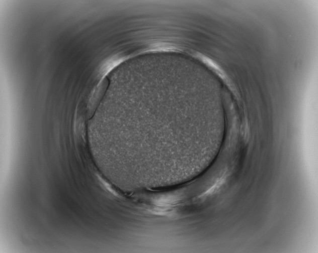 X0000086051177200704091204