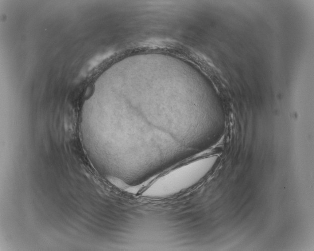 X0000086081158200704202144