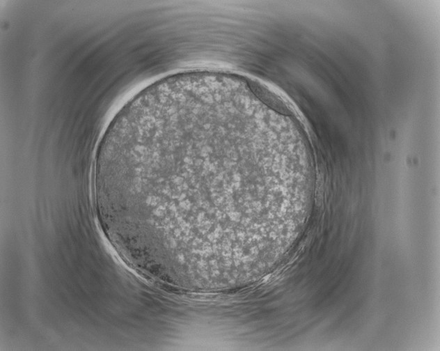 X0000086081295200704202142