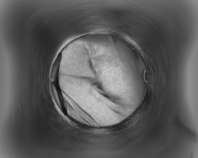 X0000086091479200704132114