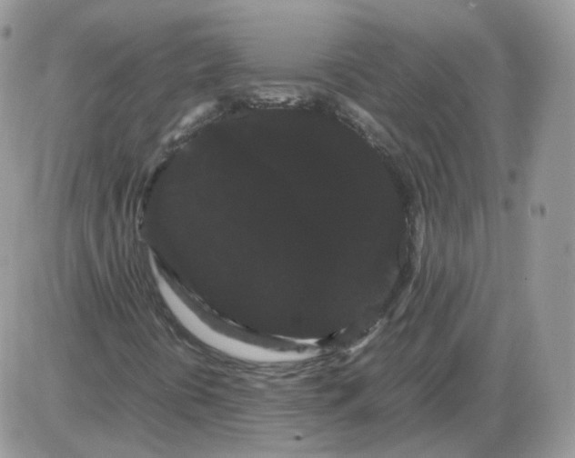 X0000086091394200704202204