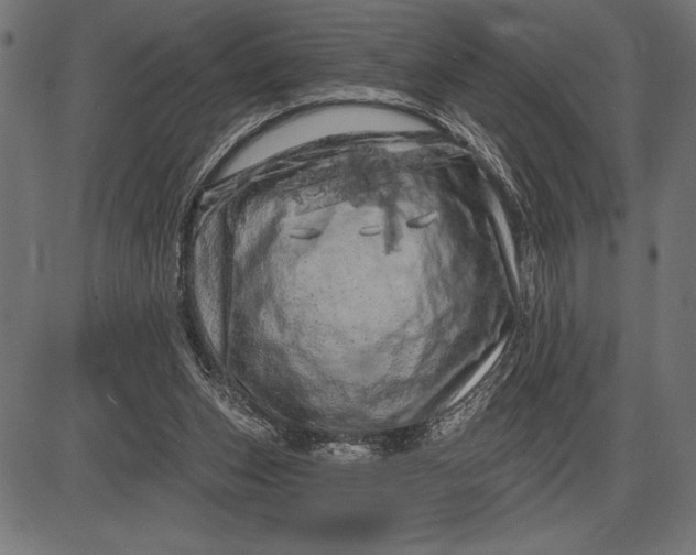 X0000086100159200704091401