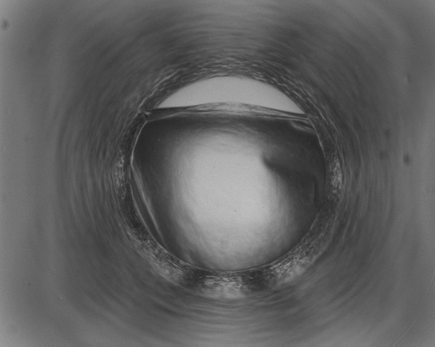 X0000086100559200704091355