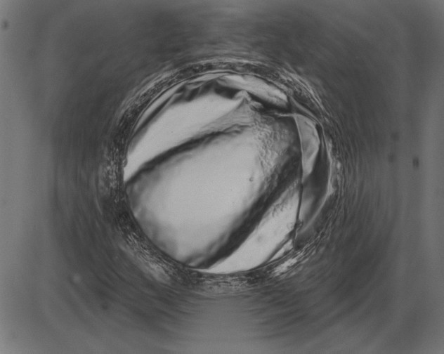 X0000086101159200704091345