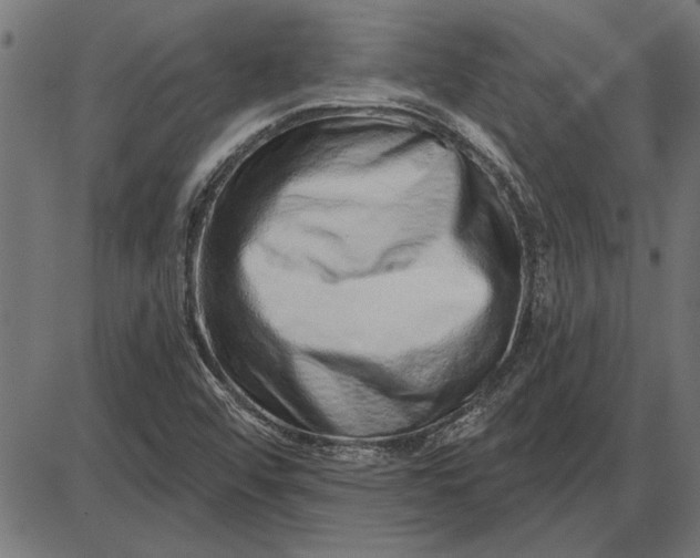 X0000086101456200704091340