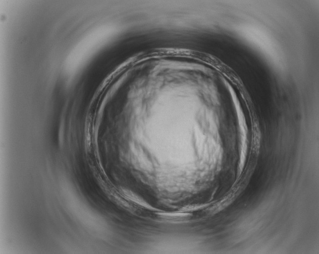X0000086101487200704091339