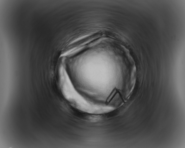 X0000086100085200704132157