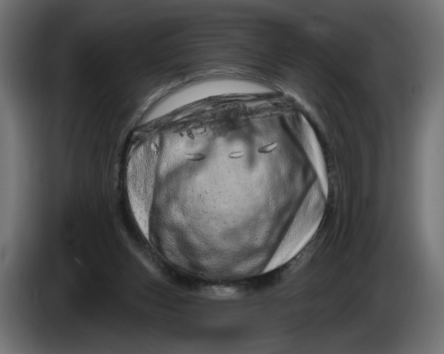 X0000086100159200704132155