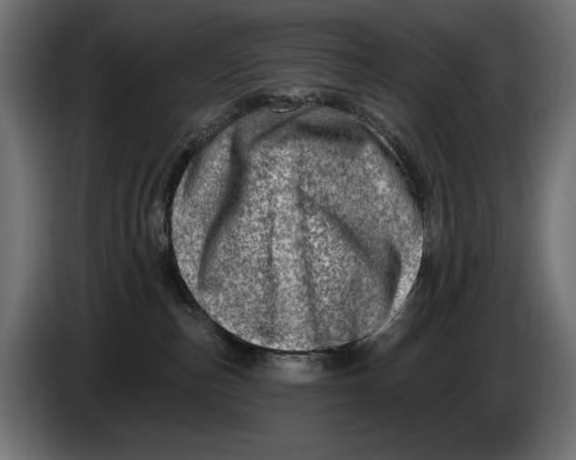 X0000086100187200704132155