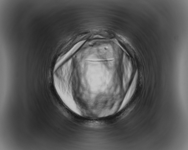 X0000086100453200704132151