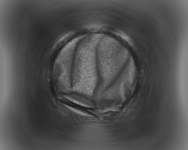 X0000086100967200704132144