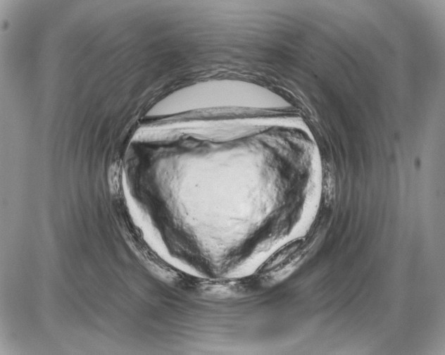 X0000086100285200704202248