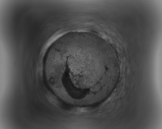 X0000086110295200703301243