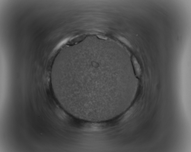 X0000086111355200703301228