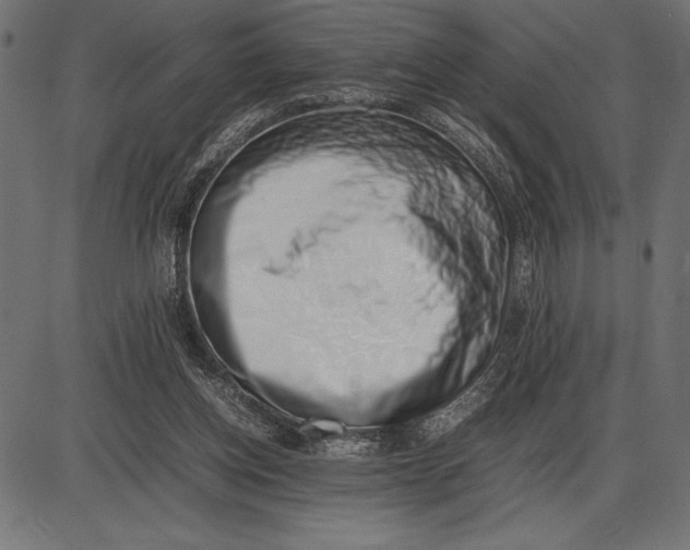 X0000086110158200704091427