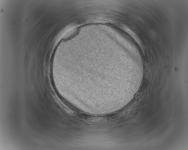 X0000086111187200704091410